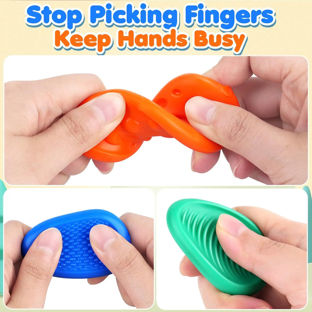 Silicone Stone Fidget Toys 6 Pack – Textured Sensory Squeeze Toys for Kids & Adults